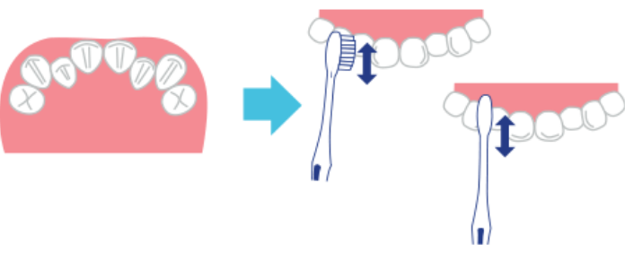 歯ブラシを縦にする
